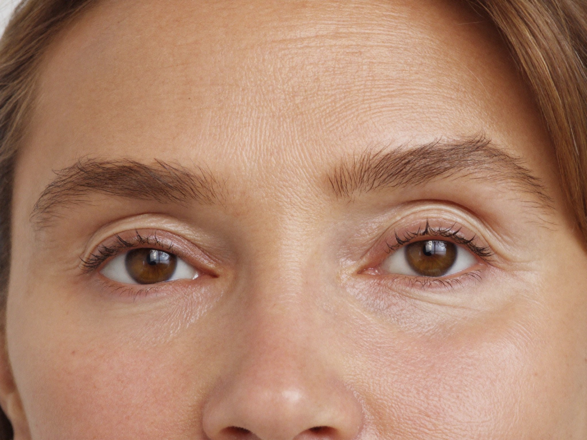 A natural, rested eye-area result — bright and open, never hollowed or overdone.
